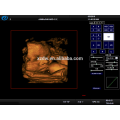 DW-C900 PC basé diagnostic médical portable échographie 4D prix de la machine